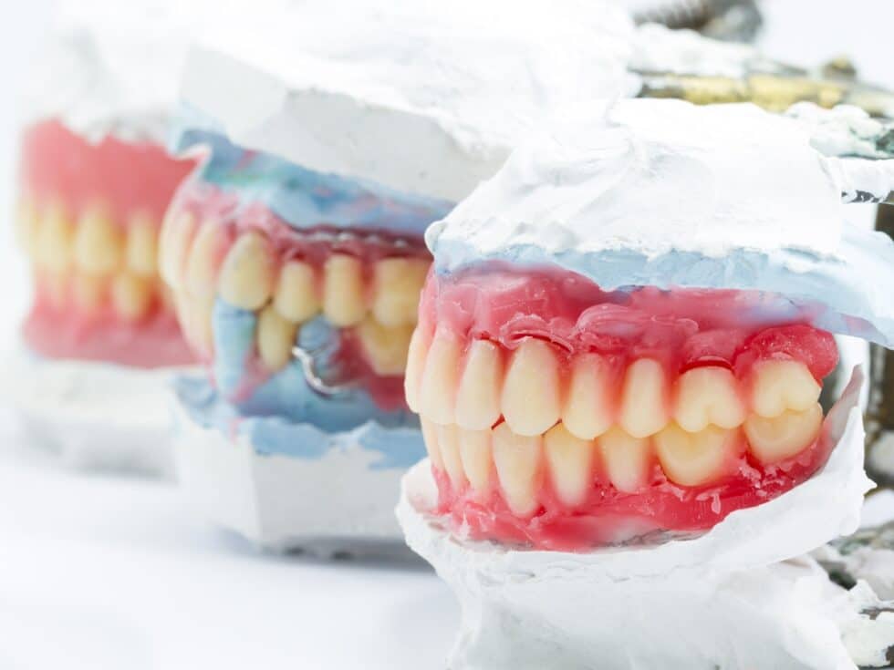 The Benefits Of Each Type Of Denture Choice Dental