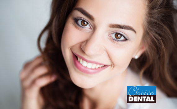 Choice-dental-veneers-treatment-Brisbane