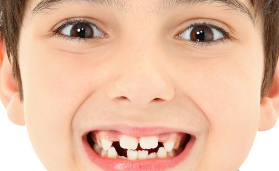 Choice-dental-browns-plains-Childrens-teeth-growth
