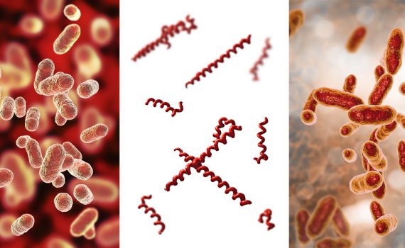 Browns-Plains-pathogenic-oral-bacteria-DNA-test