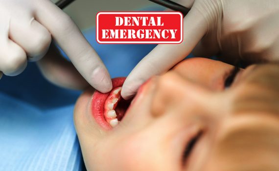 Choice-dental-browns-plains-dental-emergency-clinic