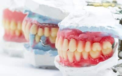 The Benefits of Each Type of Denture